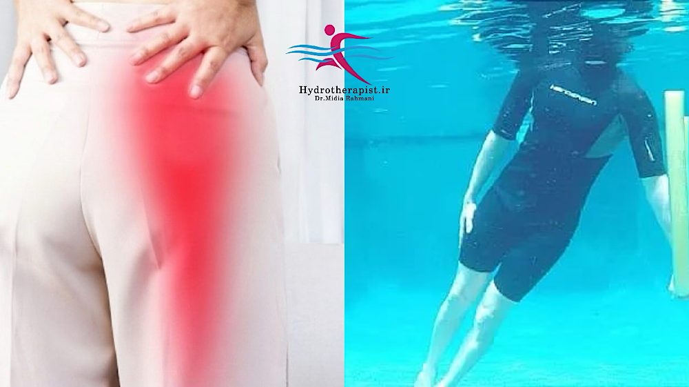 تاثیر هیدروتراپی بر درمان سیاتیک با رویکرد علمی و اصولی